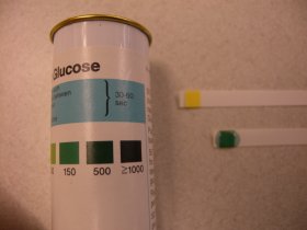 Glucose-Nachweis mit Teststäbchen