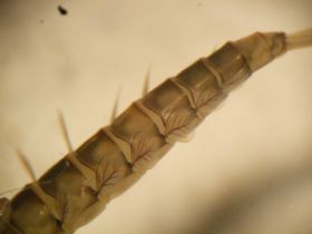 Kiemenblättchen einer Eintagsfliegenlarve (Baetis sp.)