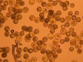 Pollenkörner vom Haselstrauch unter dem Mikroskop