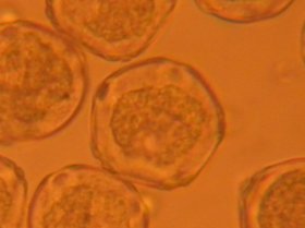 Polygonale Pollen der Schwarz-Erle mit 5 Keimöffnungen