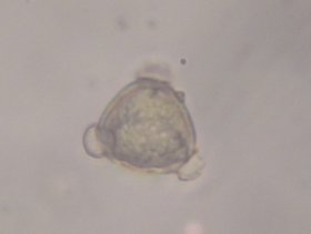 Polygonale Pollen der Kornelkirsche mit 3 Keimöffnungen
