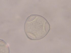 Polygonale Pollen der Haselnuss mit 3 Keimöffnungen