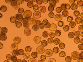 Pollen der Haselnuss