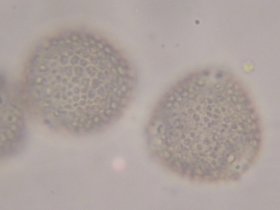 Sphärische Pollen der Forsytie mit 3 Keimöffnungen und skulpturierter Oberfläche