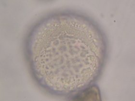 Elliptische Pollen der Gartentulpe mit skulpturierter Oberfläche